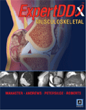 Expert Differential Diagnoses : Musculoskeletal Published by Amirsys&reg; Hardbound Book with Companion Online eBook