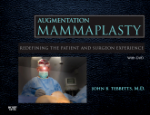 Augmentation Mammaplasty with 4DVDs - Redefining the Patient and Surgeon Experience 2010