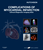 Complications of Myocardial Infarction - Clinical Diagnostic Imaging Atlas with DVD