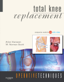 Operative Techniques: Total Knee Replacement - Book, Website and DVD 2009