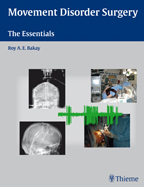 Movement Disorder Surgery : The Essentials 2009