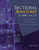 Sectional Anatomy By MRI and CT (Book with WEB Access) 3/E 2007