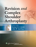 Revision and Complex Shoulder Arthroplasty Hardbound