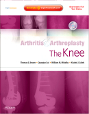 Arthritis and Arthroplasty: The Knee - Expert Consult - Online, Print and DVD 2009