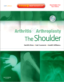 Arthritis and Arthroplasty: The Shoulder - Expert Consult - Online, Print and DVD 2009