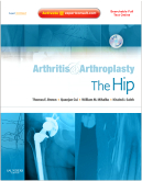 Arthritis and Arthroplasty: The Hip - Expert Consult - Online, Print and DVD 2009