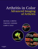Arthritis in Color - Advanced Imaging of Arthritis 2009