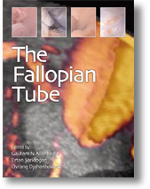 The Fallopian Tube 2009
