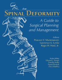 Spinal Deformity: A Guide to Surgical Planning and Management + DVD 2008