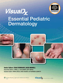 Visualdx Essential Pediatric Dermatology 2009