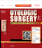 Otologic Surgery, 3rd Edition - with Video & QA, Expert Consult - Online and Print