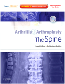 Arthritis and Arthroplasty: The Spine - Expert Consult - Online, Print and DVD  2010