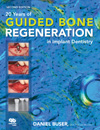 20 Years of Guided Bone Regeneration in Implant Dentistry, Second Edition