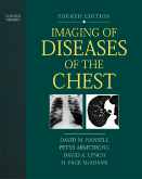 Imaging of Diseases of the Chest, 4th Edition