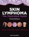 Skin Lymphoma: The Illustrated Guide, 3/E 2009