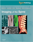 Imaging of the Spine - Expert Radiology Series, Expert Consult-Online and Print