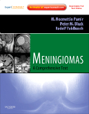 Meningiomas - Expert Consult - Online and Print 2010