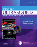 Vascular Ultrasound, 3rd Edition - How, Why and When