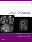 Brain Imaging, 2nd Edition - Case Review