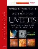 Uveitis, 4th Edition - Fundamentals and Clinical Practice: Expert Consult - Online and Prin 2010