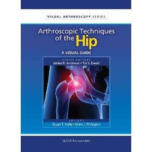 Arthroscopic Techniques of the Hip: A Visual Guide (Visual Arthroscopy) (Paperback)