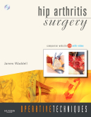 Operative Techniques: Hip Arthritis Surgery