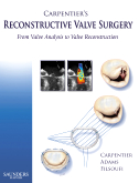Carpentier's Reconstructive Valve Surgery 2010
