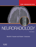 Neuroradiology, 3rd Edition The Requisites