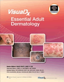 VisualDx: Essential Adult Dermatology 2010