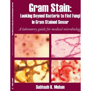 Gram Stain: Looking Beyond Bacteria to Find Fungi in Gram Stained Smear. a Laboratory Guide for Medical Microbiology