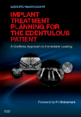 Implant Treatment Planning for the Edentulous Patient A Graftless Approach to Immediate Loading