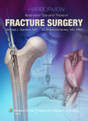 Harborview Illustrated Tips and Tricks in Fracture Surgery Hardbound
