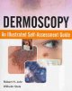 Dermoscopy: An Illustrated Self-Assessment Guide