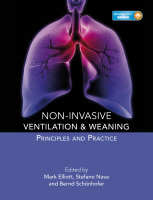 Non-invasive Ventilation and Weaning: Principles and Practice(with web code)  2010
