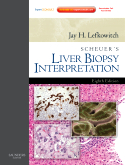Scheuer's Liver Biopsy Interpretation, 8/E 2010
