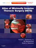 Atlas of Minimally Invasive Thoracic Surgery (VATS) Expert Consult - Online and Print, with DVD(已絕版)