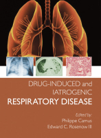 Drug-induced and Iatrogenic Respiratory Disease 2011