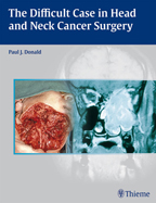 The Difficult Case in Head and Neck Cancer Surgery  2010