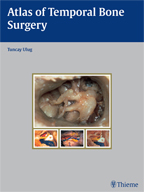 Atlas of Temporal Bone Surgery 2010