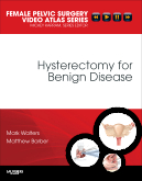 Hysterectomy for Benign Disease : Female Pelvic Surgery Video Atlas Series 2010