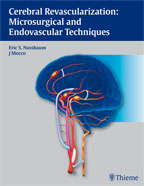 Cerebral Revascularization Microsurgical and Endovascular Techniques 2011