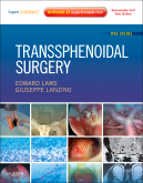 Transsphenoidal Surgery Expert Consult - Online and Print