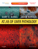 Atlas of Liver Pathology Expert Consult - Online and Print 3/E 2011