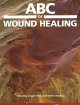 ABC of Wound Healing