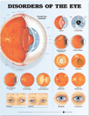 Disorders of the Eye Anatomical Chart Laminated
