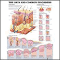 Skin and Common Disorders Anatomical Chart Paper Unmounted Paper Chart