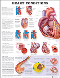 Heart Conditions Plastic Styrene Styrene