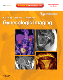 Gynecologic Imaging Expert Radiology Series (Expert Consult - Online and Print) 2011