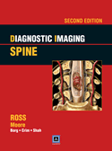 Diagnostic Imaging: Spine Published by Amirsys&reg; Hardbound 2/E