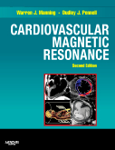 Cardiovascular Magnetic Resonance, 2nd Edition